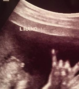 Feto faz suposto sinal de 'mão-chifrada' em ultrassom e pais ficam orgulhosos