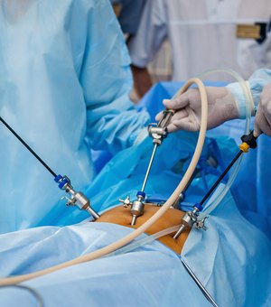Maceioense morre após complicações de cirurgia bariátrica; saiba mais sobre o procedimento
