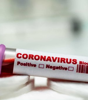 Sobem para 34 os casos de coronavírus em Alagoas