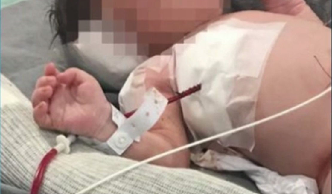 Bebê vítima de bala perdida na barriga da mãe nasce paraplégico, afirma secretário 