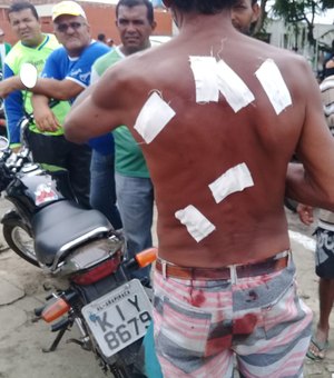 Trabalhador leva facadas nas costas na feira de Arapiraca