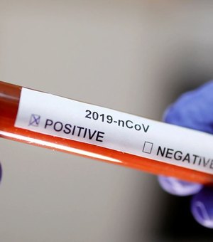 Brasil bate novo recorde de morte por coronavírus em um dia