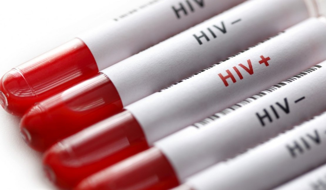 Aids: da epidemia mundial ao tratamento gratuito no Brasil