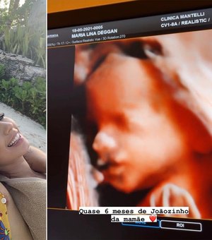 Maria Lina mostra rosto do bebê que espera com Whindersson em ultrassom