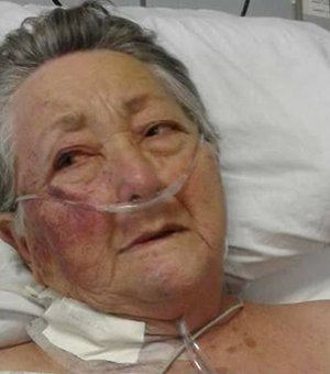'Ele me bateu até cansar', diz idosa agredida por enfermeiro em UTI
