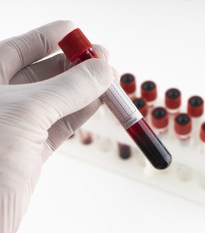 Ministério da Saúde vai testar maceioenses para a covid-19