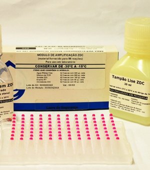 Fiocruz obtém registro de teste para zika, dengue e chikungunya