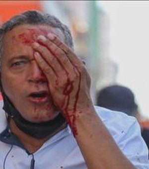Governo de Pernambuco vai indenizar feridos pela PM durante manifestação