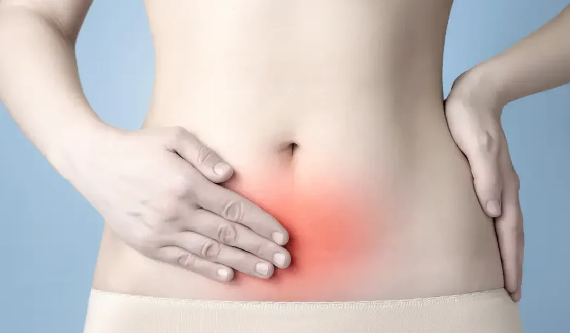 Endometriose: conheça as causas, sintomas e tratamento da doença que afeta Anitta