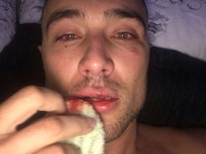 Youtuber apanha de PMs em SP e tudo indica que foi homofobia