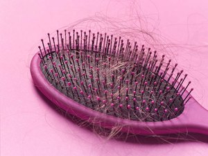 Pacientes com Covid-19 relatam perda de cabelo excessiva depois da infecção