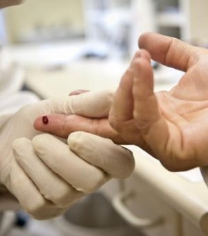 Remédio que previne contaminação pelo vírus HIV será oferecido pelo SUS este mês