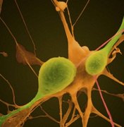 Pesquisa desvenda causa da Esclerose Lateral Amiotrófica