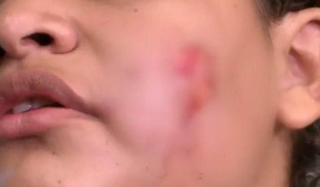 Homem agride mulher com mordida no rosto