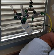 Profissionais de saúde usam 'gambiarra de oxigênio' para socorrer pacientes com Covid-19