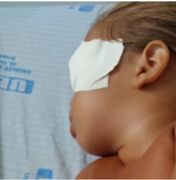 Médico avalia bebê que sofreu acidente doméstico e diz que sua visão pode ser restabelecida