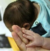 Mães de bebês com microcefalia enfrentam drama para conseguir remédios gratuitos