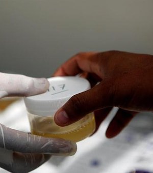 Covid: brasileiros criam teste de urina mais preciso que exame de sangue na detecção de anticorpos