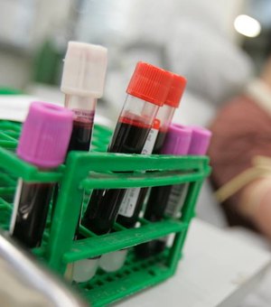 Falta de reagente impede execução de exames de sangue no HGE