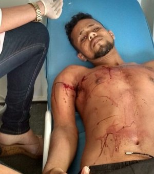 Briga entre rivais termina com duas pessoas gravemente feridas na Região Metropolitana
