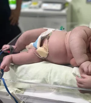 'Bebê Gigante' nasce com mais de 7 kg em maternidade de Parintins, no interior do AM