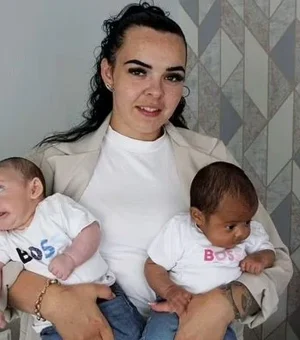 Mulher dá à luz gêmeos com tons de pele completamente diferentes