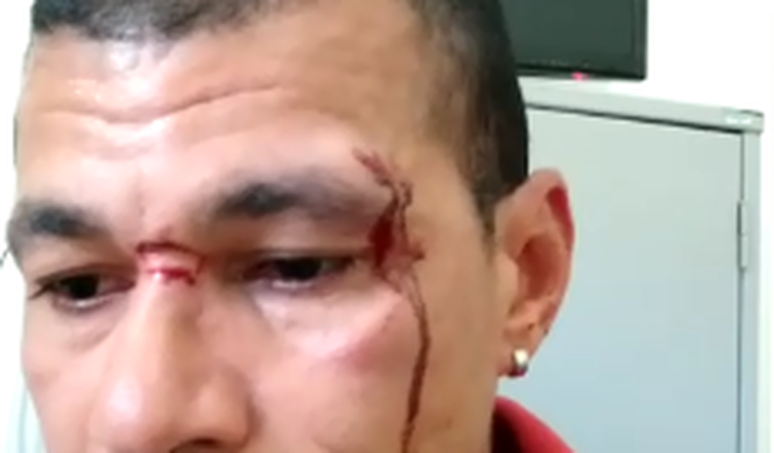 [Vídeo] Radialista denuncia agressão por segurança de prefeito 