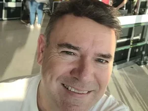 Ex-calvo pula de alegria após implante de cabelo: “Posso morrer feliz”