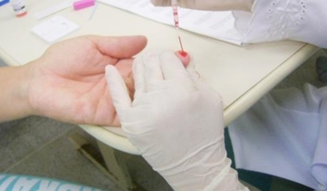 Hospital Helvio Auto fará testes para detectar Hepatites B e C