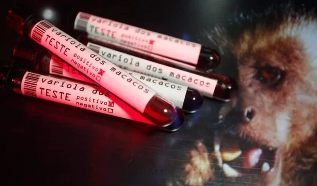 Ministério da Saúde confirma 9º caso de varíola dos macacos no Brasil