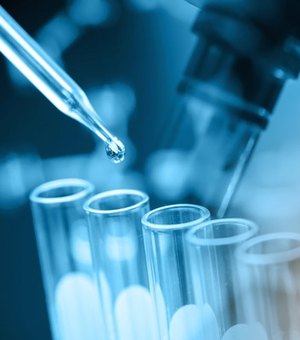 Laboratório japonês testará detecção de câncer com mostras de urina