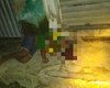 Jovem baleado em Luziápolis morre em hospital de Arapiraca
