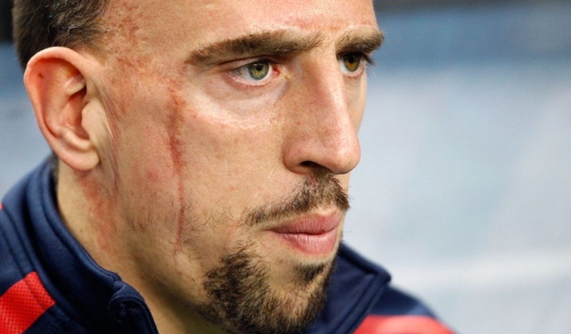 Ribéry é cortado por lesão e não jogará a Copa do Mundo