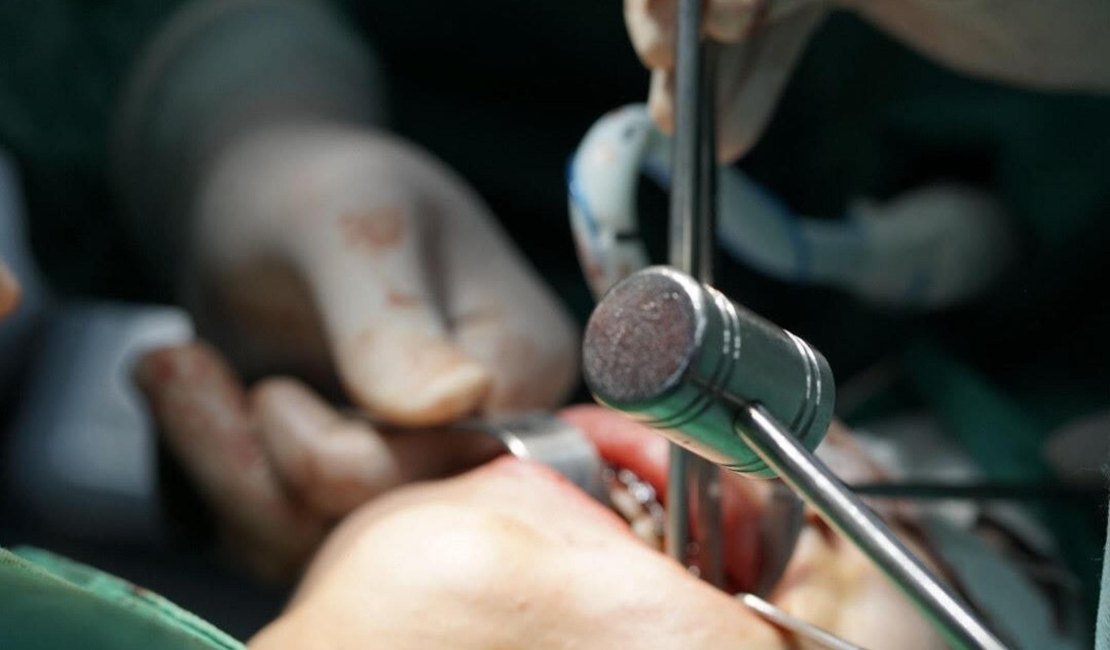 Hospital Regional do Norte é o primeiro da Rede Pública do Estado a realizar a cirurgia ortognática