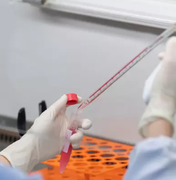 Cientistas relatam 35 pessoas infectadas pelo novo vírus Langya na China
