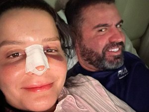 Maraisa faz diversos agradecimentos após sofrer fratura no nariz em Alagoas