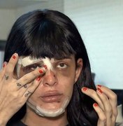 Modelo trans espancada em Copacabana reconhece agressor
