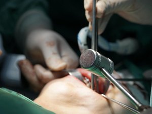 Hospital Regional do Norte é o primeiro da Rede Pública do Estado a realizar a cirurgia ortognática