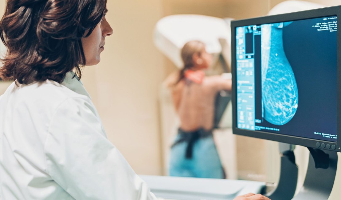 Mamografias caem 75% durante pandemia; médica fala sobre a importância do exame
