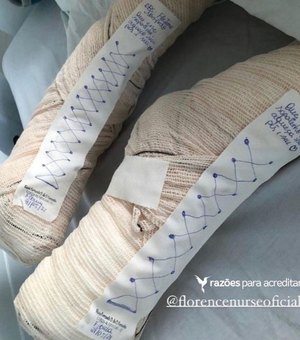Enfermeira de Maceió viraliza ao fazer sapatinhos improvisados para aquecer pés de paciente