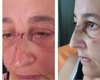 Mulher é atacada com bexiga d’água, leva pontos e pega infecção ocular