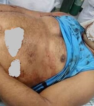 Crime brutal: vigilante é assassinado a facadas em Japaratinga