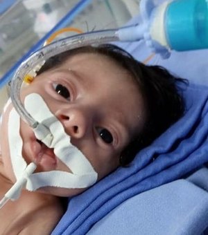 Bebê João Arthur pode ser diagnosticado com outra doença rara
