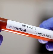 Governo confirma quarto caso de coronavírus no país 