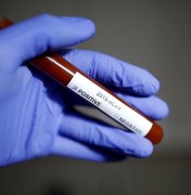 Casos confirmados de coronavírus sobem para 1.128; Brasil tem 18 mortes