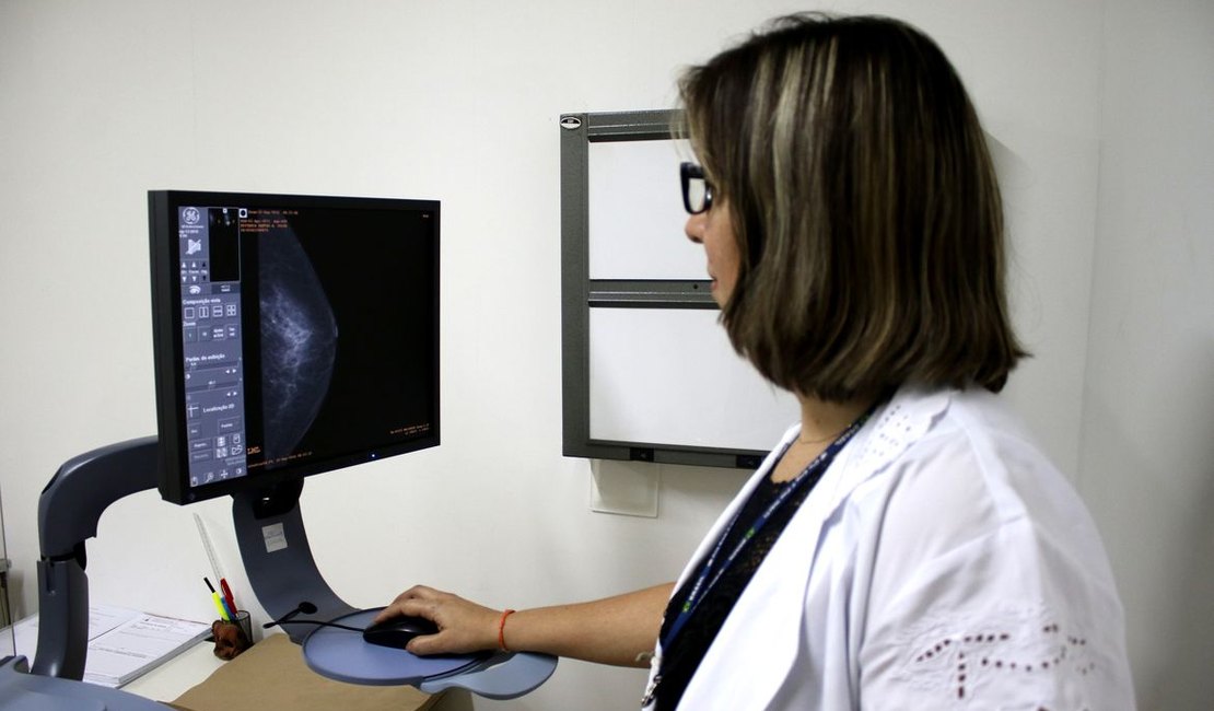 Pesquisa mostra desconhecimento sobre prevenção do câncer de mama