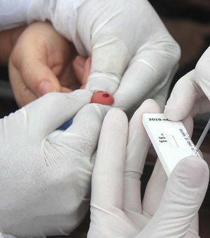 Testes de Covid-19 estão em falta nas farmácias e laboratórios de Arapiraca