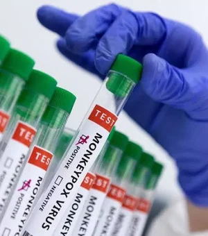 Maceió confirma 15º caso de varíola dos macacos