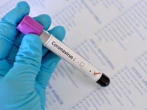 Covid-19: Alagoas registra 1,2 mil novos casos e 22 mortes neste domingo