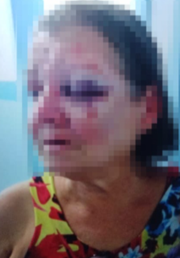 Delegacia de Campo Alegre conclui inquérito de filho que espancou a própria mãe